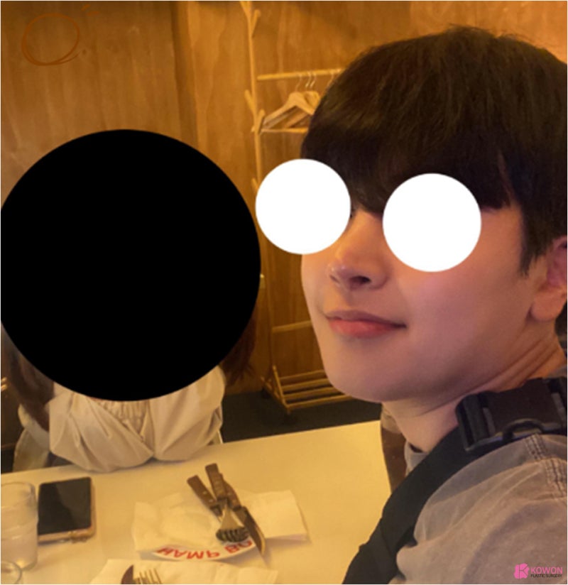코재수술추천 콧구멍짝짝이 개선 만족 이유 사진 12