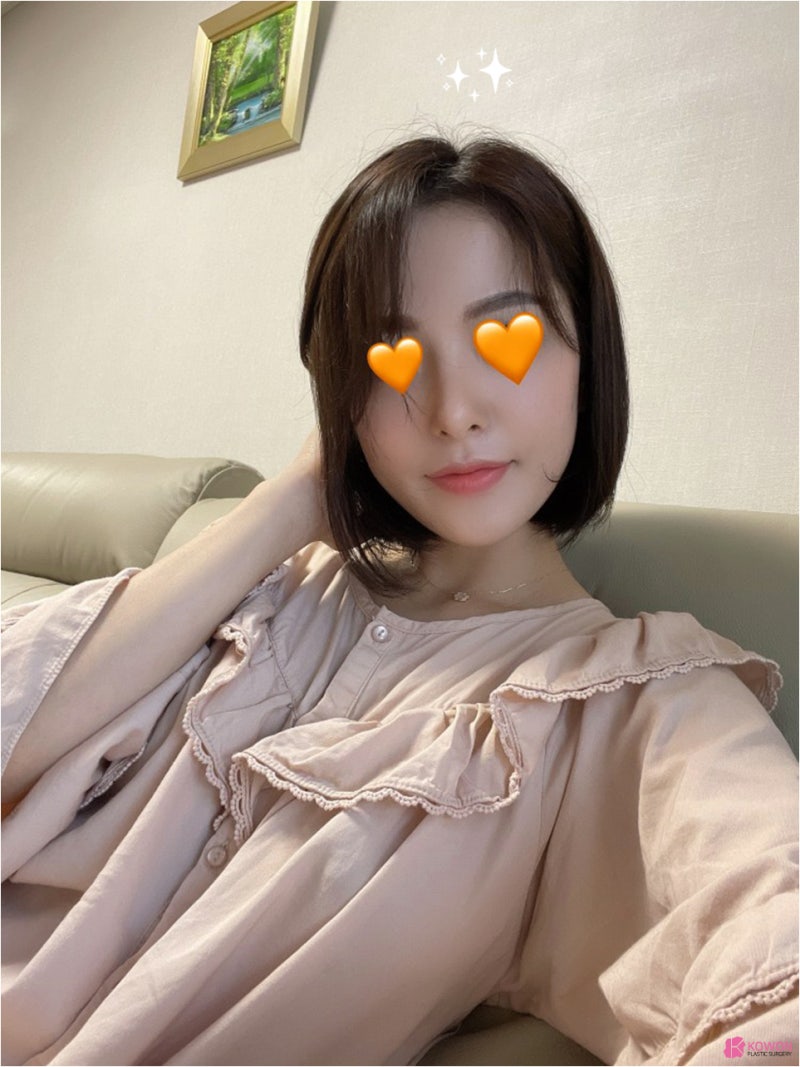 신사역코성형외과 조화로운 작은코성형 후기 사진 12