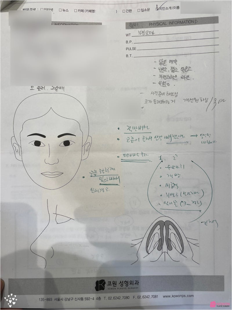 신사역코성형외과 조화로운 작은코성형 후기