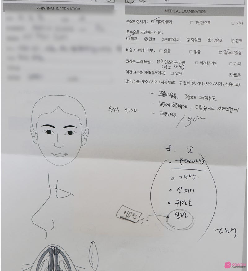 복코콧대 만드는 방법 가로수길성형외과