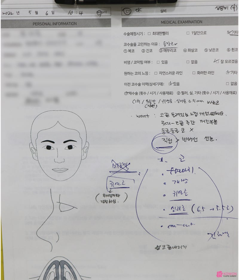 콧구멍보이는코 재수술 남성 환자 역삼성형외과