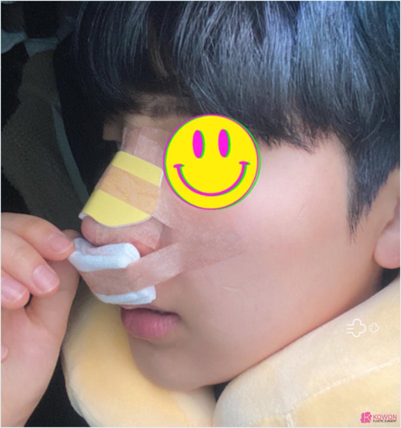 코재수술병원 코비대칭 콤플렉스 맞춤형 디자인 사진 5