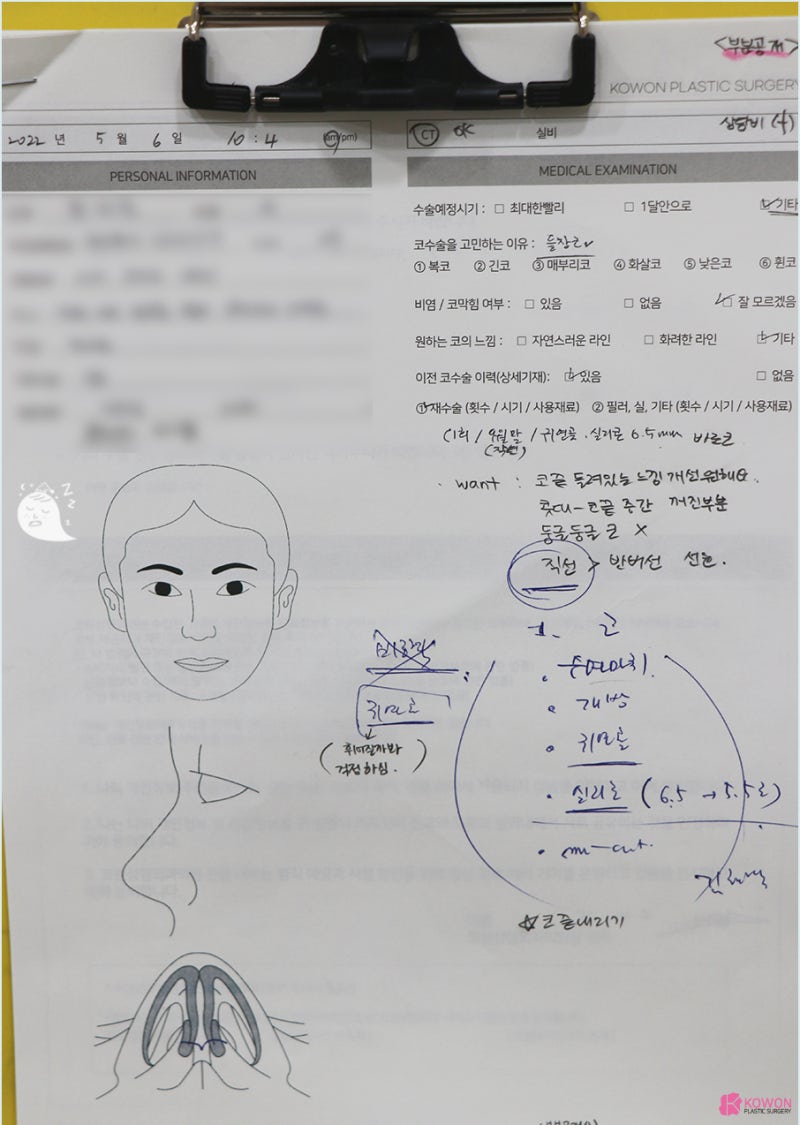 코재수술병원 코비대칭 콤플렉스 맞춤형 디자인