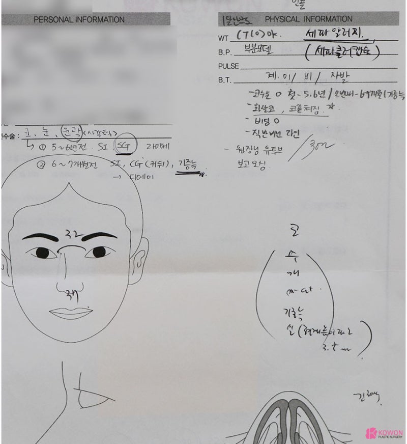 웃을때 화살코 스트레스라면 코성형유명한곳