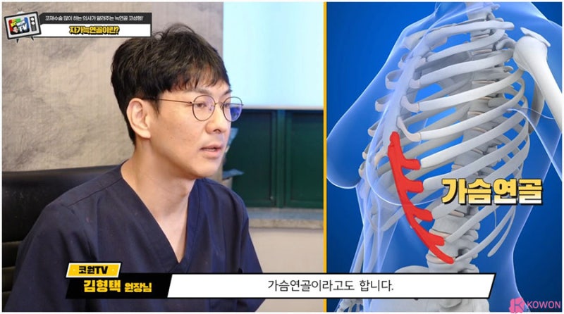 강남코재수술 방법 종류 코늑연골 장점 특징 사진 7