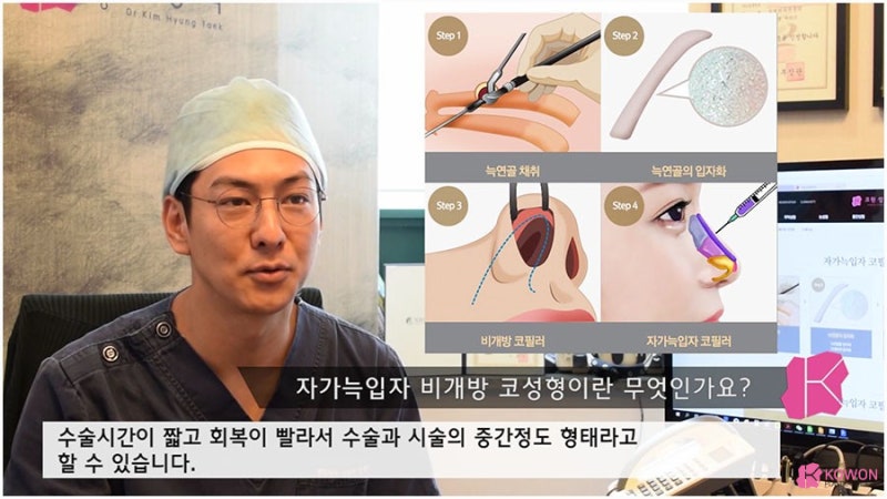 비개방코성형 수술 방법 대상 강남구성형외과 사진 5