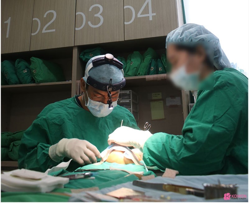 예쁜코 만드는 수술 방법 강남코성형잘하는곳 추천 사진 6