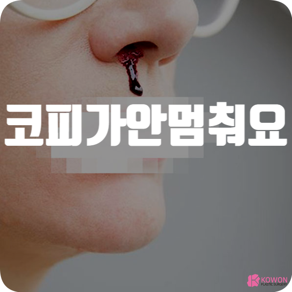 코피가안멈춰요 증상 호소한다면 대처 방법
