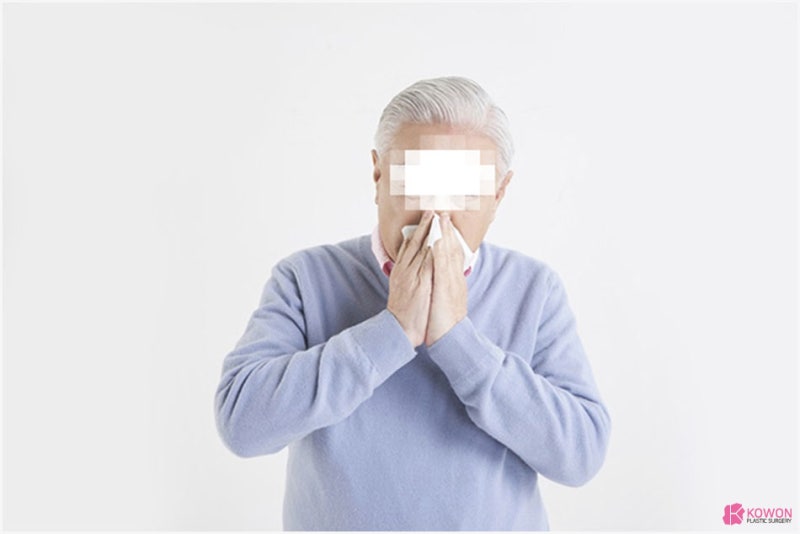 코피가안멈춰요 증상 호소한다면 대처 방법 사진 7