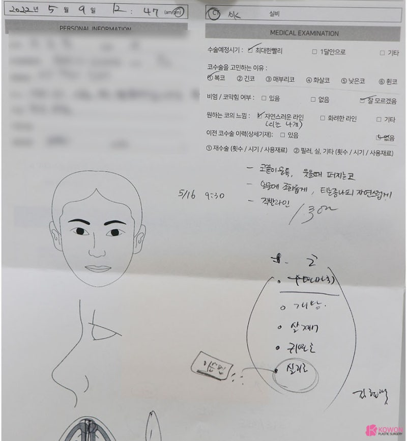 복코수술후기 강남성형외과순위 높은 곳