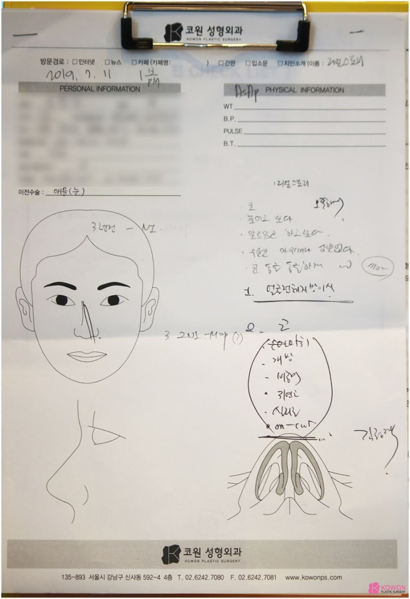 여자작은코 이미지 변화 강남신사동성형외과