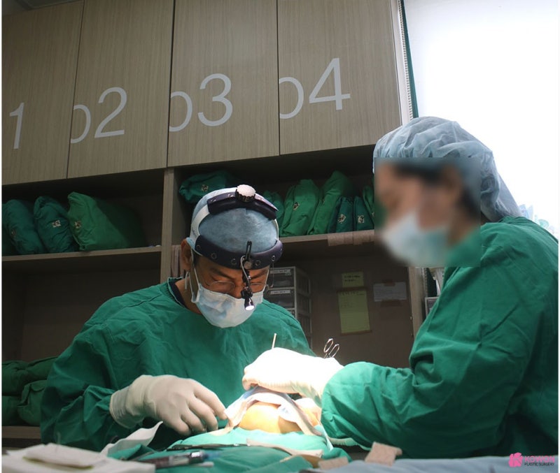 넓은코성형 코재건수술 통해 원하는 결과를 사진 6