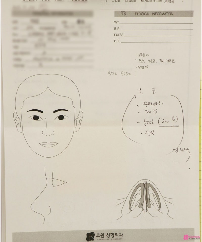 들린코성형 콤플렉스 개선 강남구청성형외과