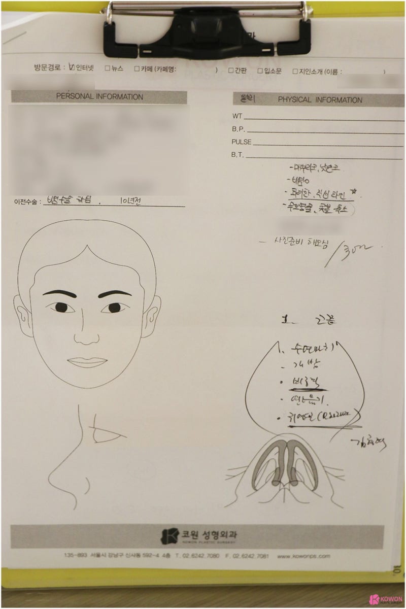 비염코성형수술 문제 개선한 압구정로데오성형외과 사진 2