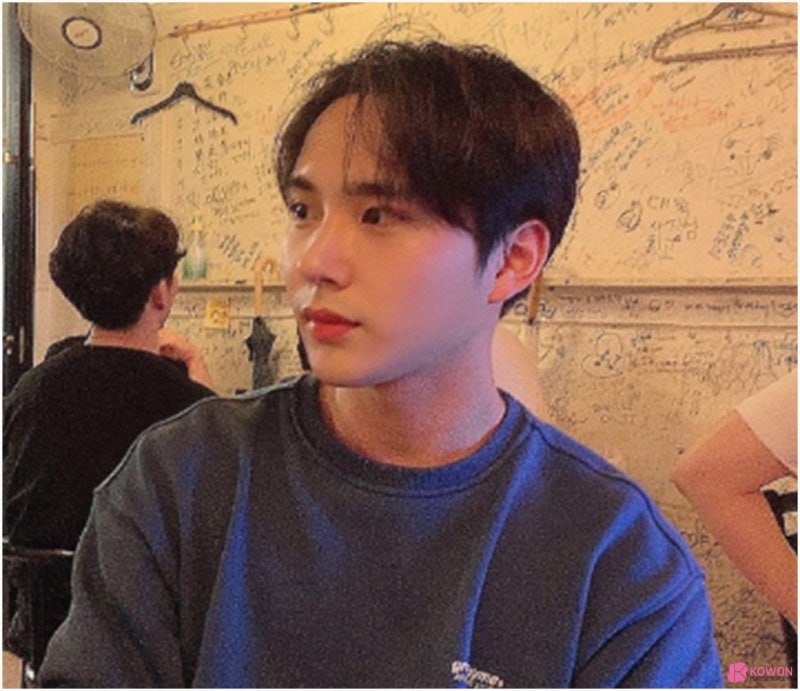 비염코성형수술 문제 개선한 압구정로데오성형외과 사진 6