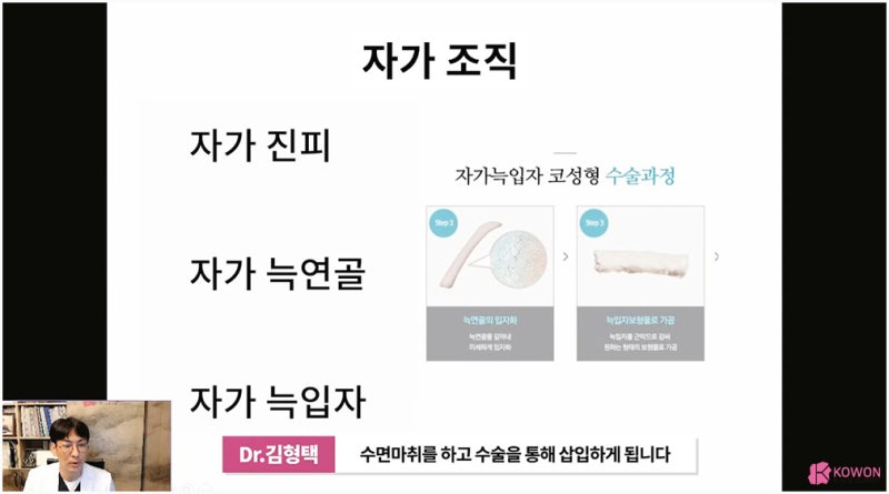 코실리프팅제거 방법 주의사항 서울코성형 사진 3