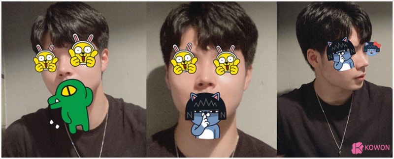 코끝각도 변화 코성형한달 후기 비교 사진 7