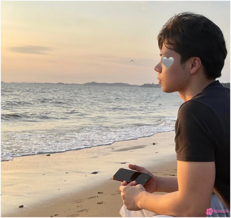코끝각도 변화 코성형한달 후기 비교 사진 11