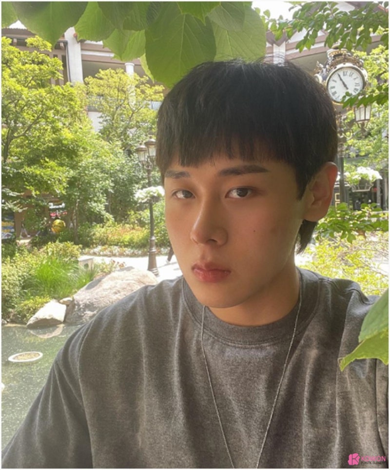 남자코성형전후 세련된코 수술 사례 사진 8