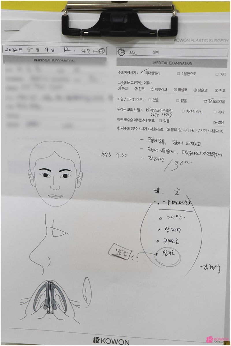 살찐코 콤플렉스 해결 가능한 코성형잘하는곳