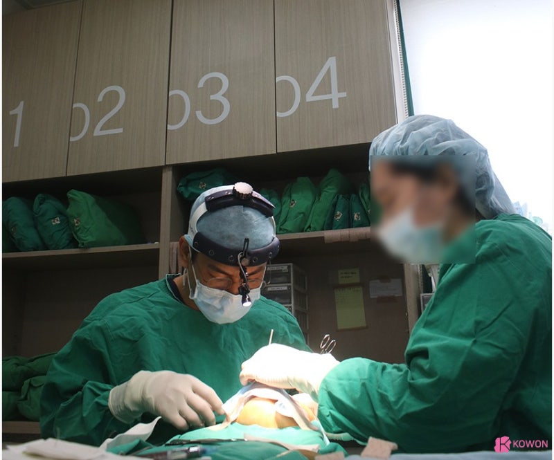 짧은코수술 효과 콧구멍비대칭 개선까지 사진 7