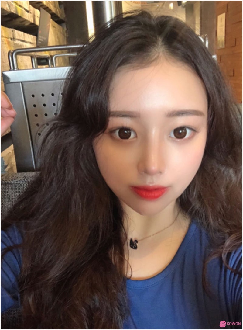 귀연골코수술 통해 작고낮은코 고민 해결 사진 7