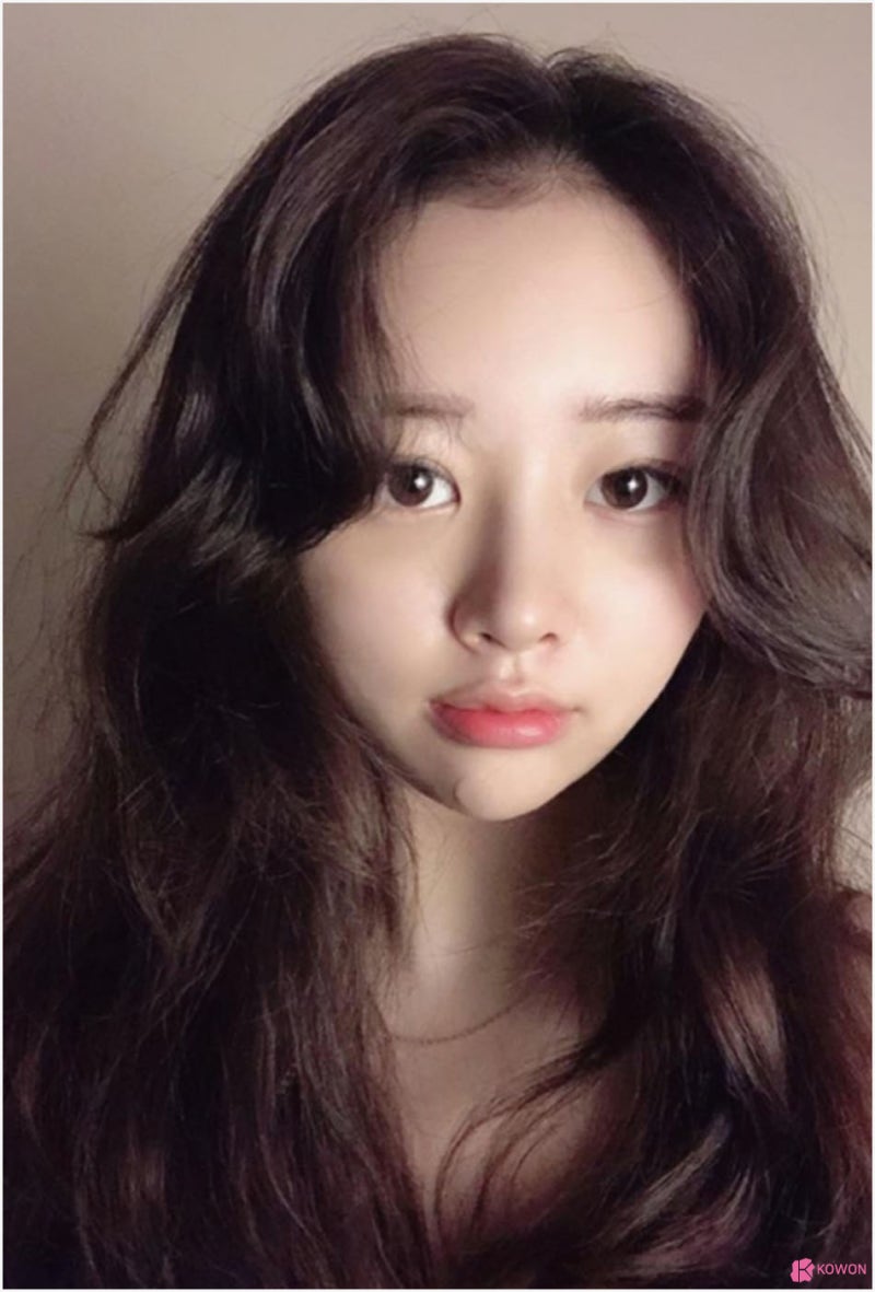 귀연골코수술 통해 작고낮은코 고민 해결 사진 6
