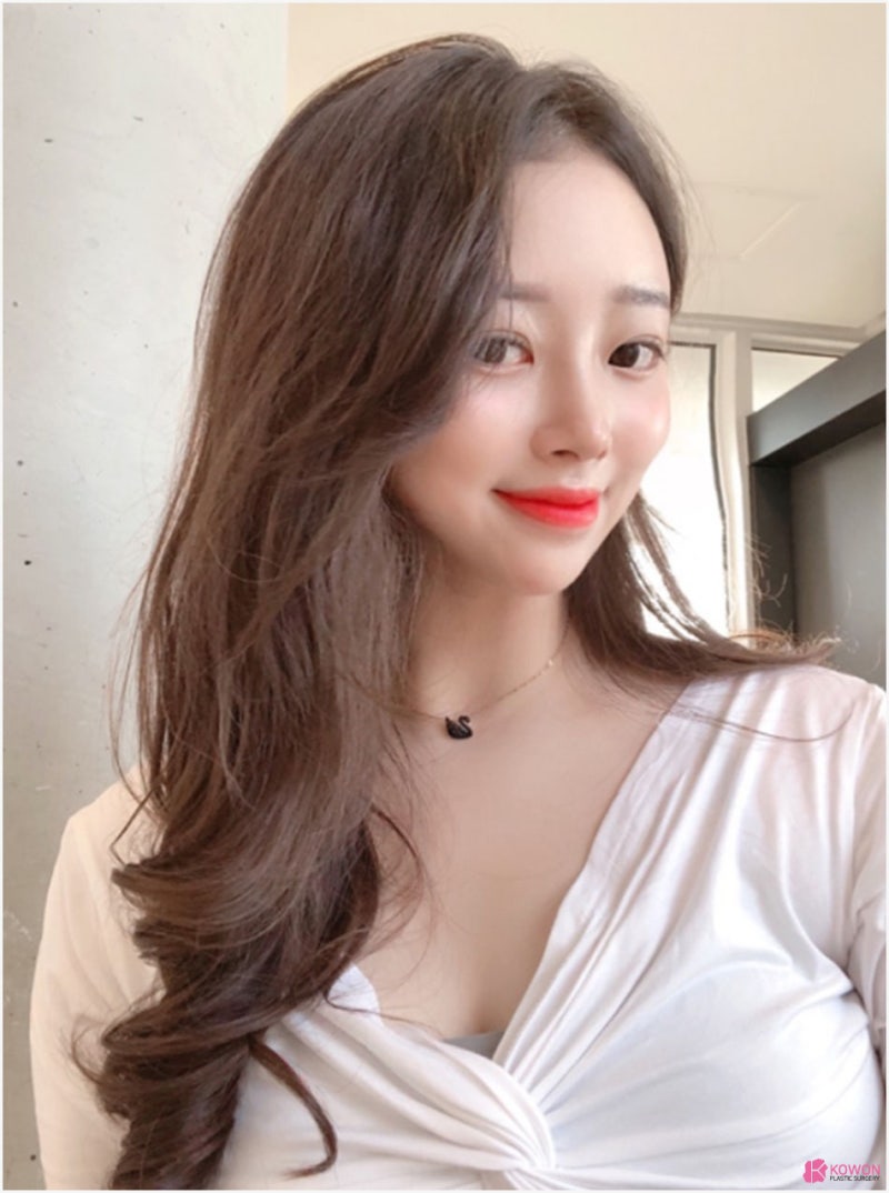 귀연골코수술 통해 작고낮은코 고민 해결 사진 9