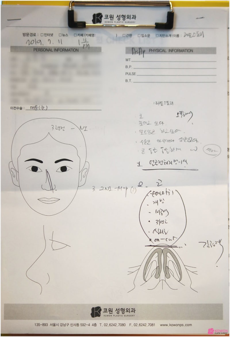 귀연골코수술 통해 작고낮은코 고민 해결 사진 2