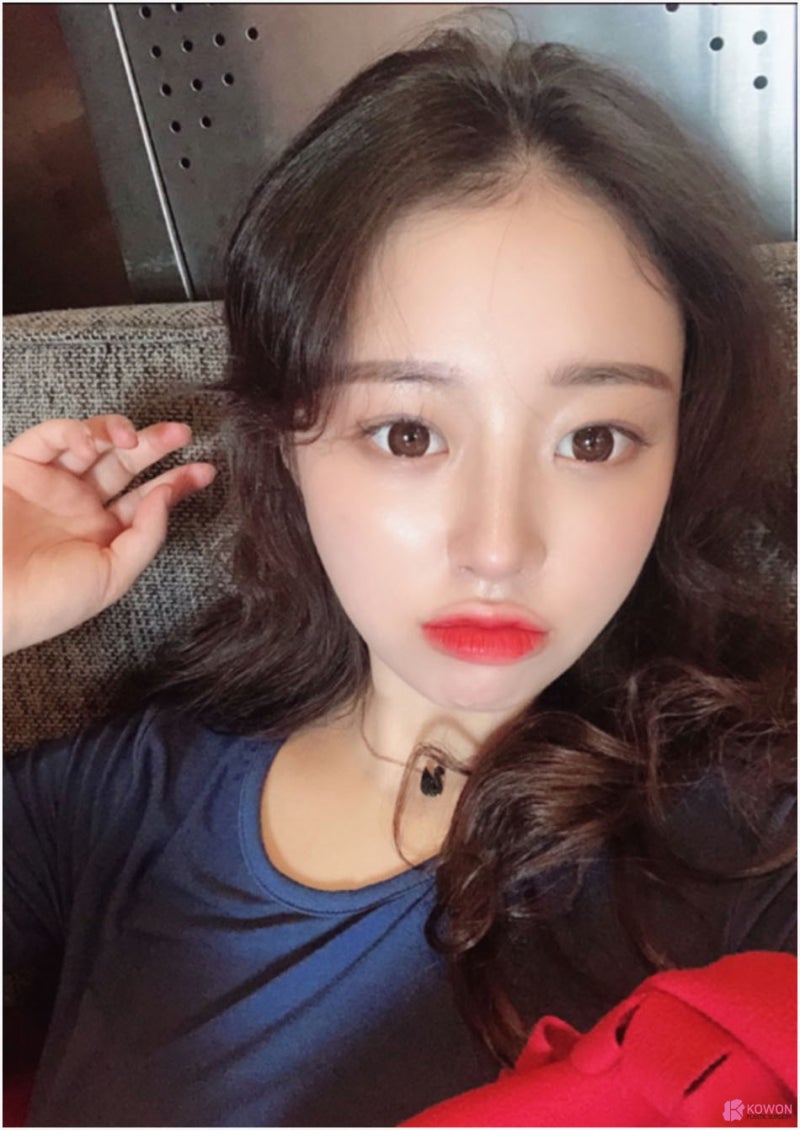 귀연골코수술 통해 작고낮은코 고민 해결 사진 8