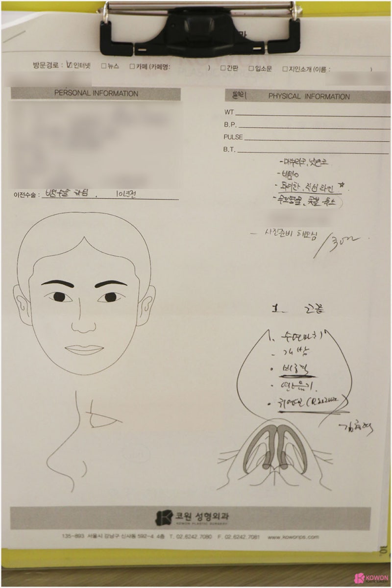 기능코성형외과 찾는다면 코끝모양 개선법 사진 5