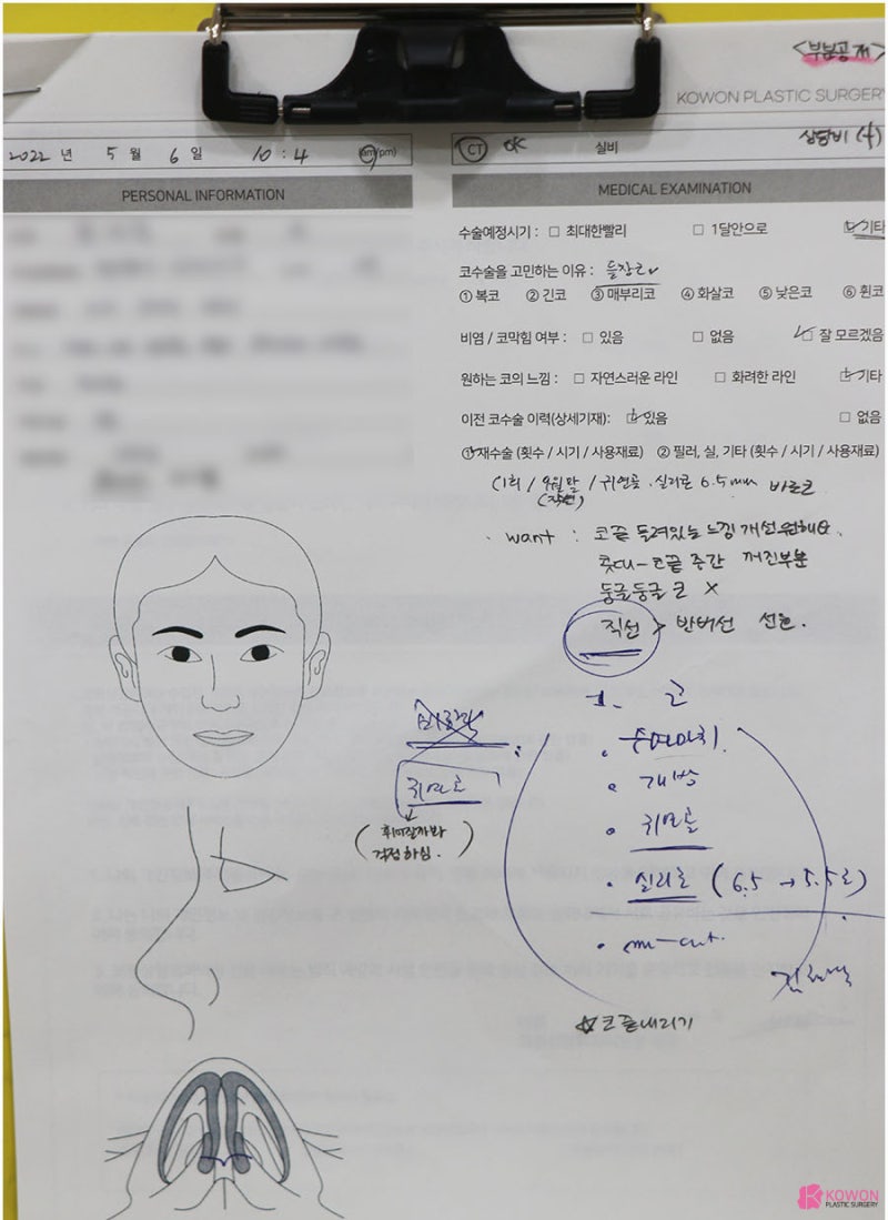 신사역코성형 들창코수술 통한 콤플렉스 해결