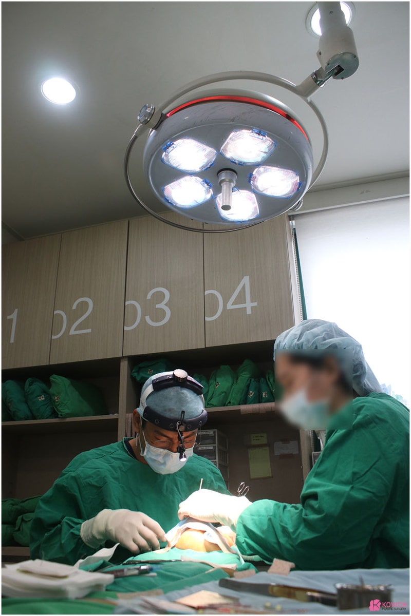 매부리코성형부작용 강남코재수술잘하는곳 사진 3