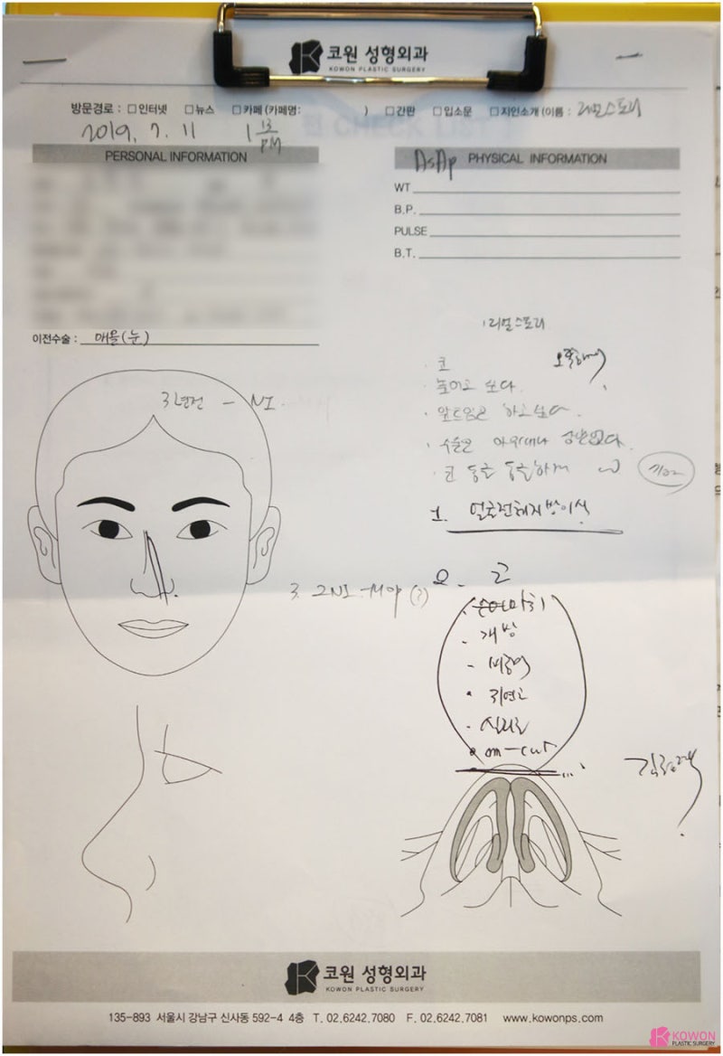 낮은코수술 사례 코성형외과추천