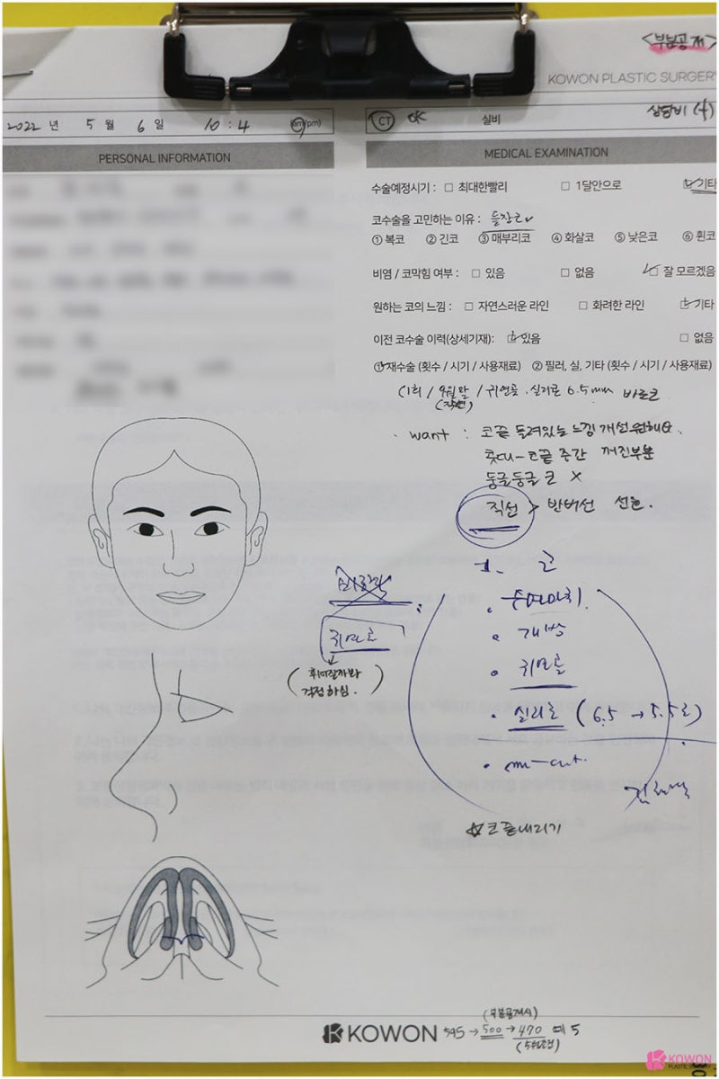 콧구멍짝짝이 교정한 방법 청담동성형외과