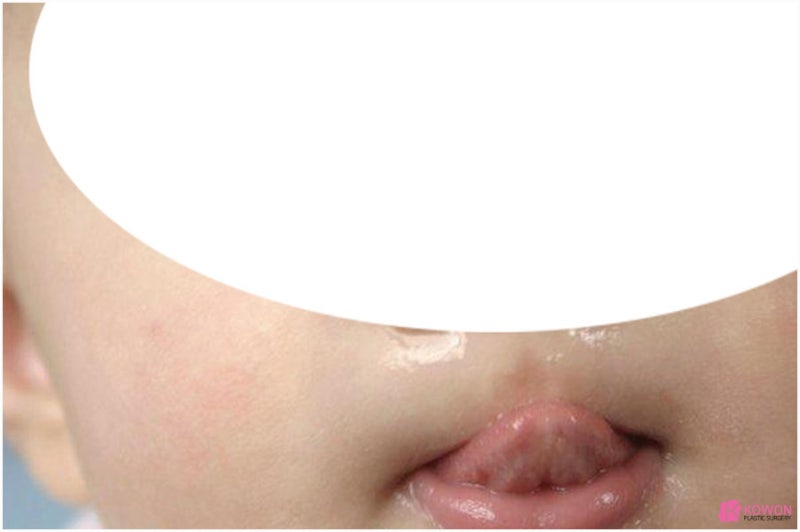 코딱지생기는이유 콧물 역할 원인 궁금하다면