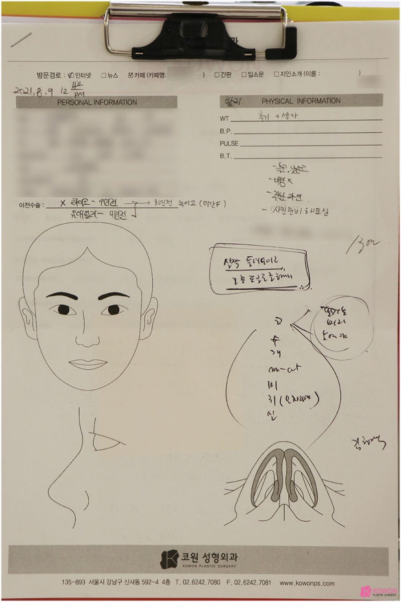 높은콧대 성형 사례 복코수술전후 이미지 변화