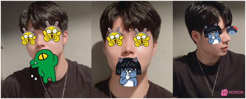 복코개선 남성 환자 통통한코 고민이라면 사진 7