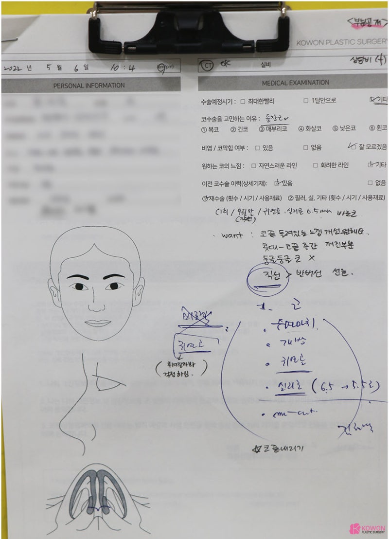 콧구멍보이는코 코콤플렉스 해결 가능한 곳