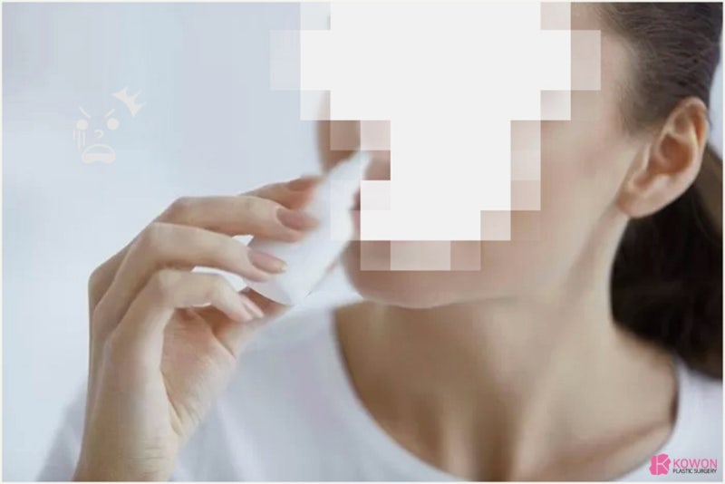 코 점막 부음 부비동염 원인 및 완화 방법 사진 7