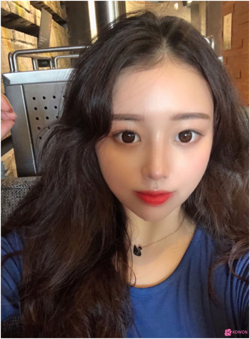 작은코수술 통한 이미지 변화 압구정동성형외과 사진 7