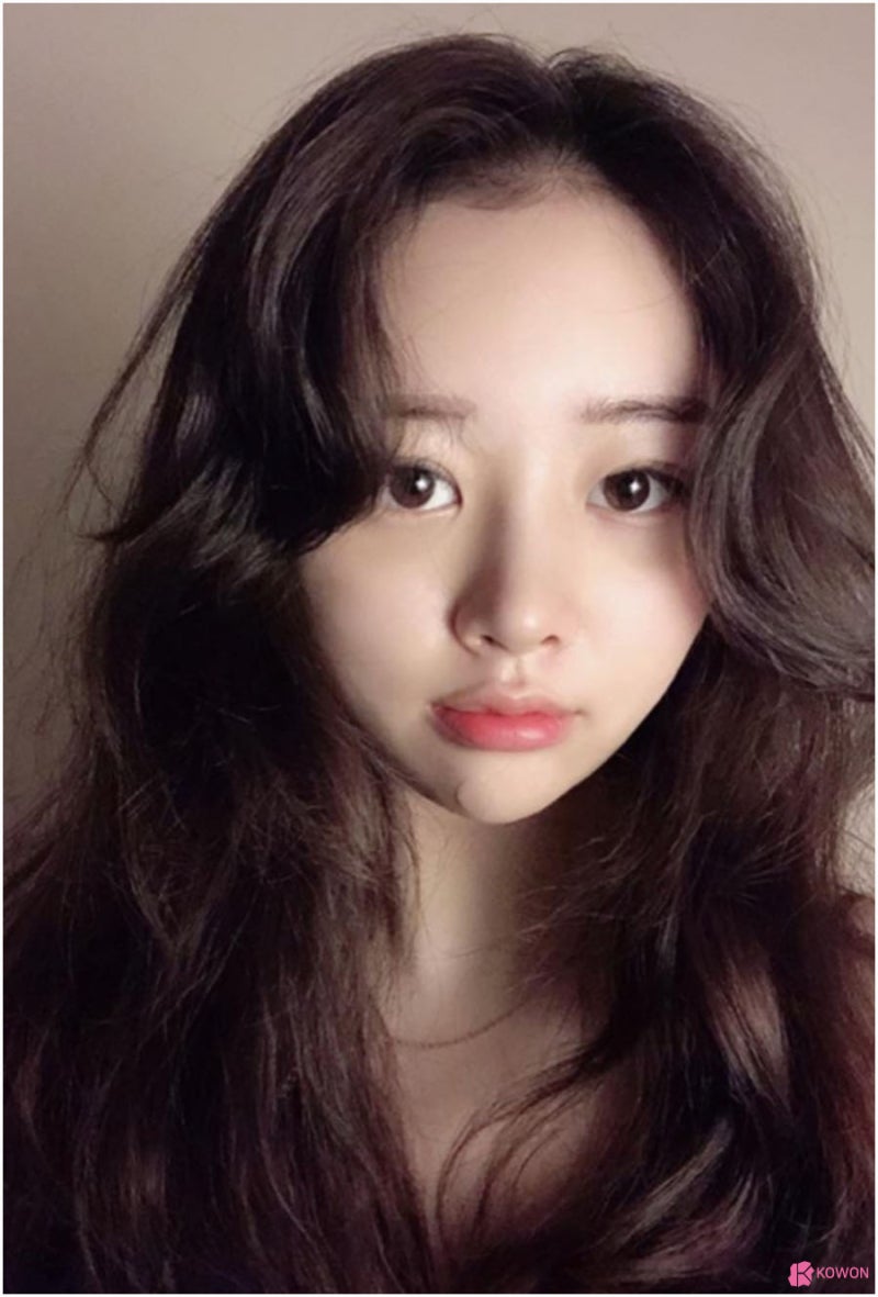 작은코수술 통한 이미지 변화 압구정동성형외과 사진 6