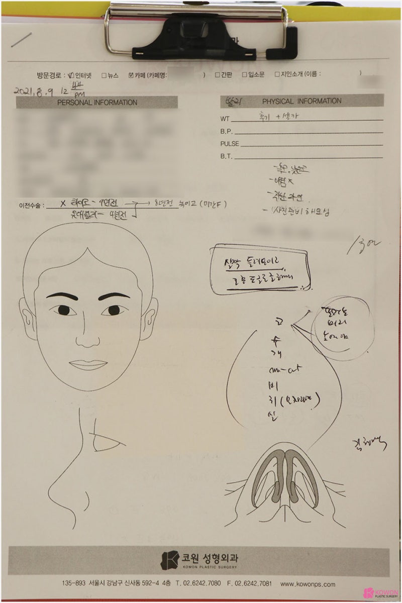 비중격휨 모양 기능 개선 논현동성형외과