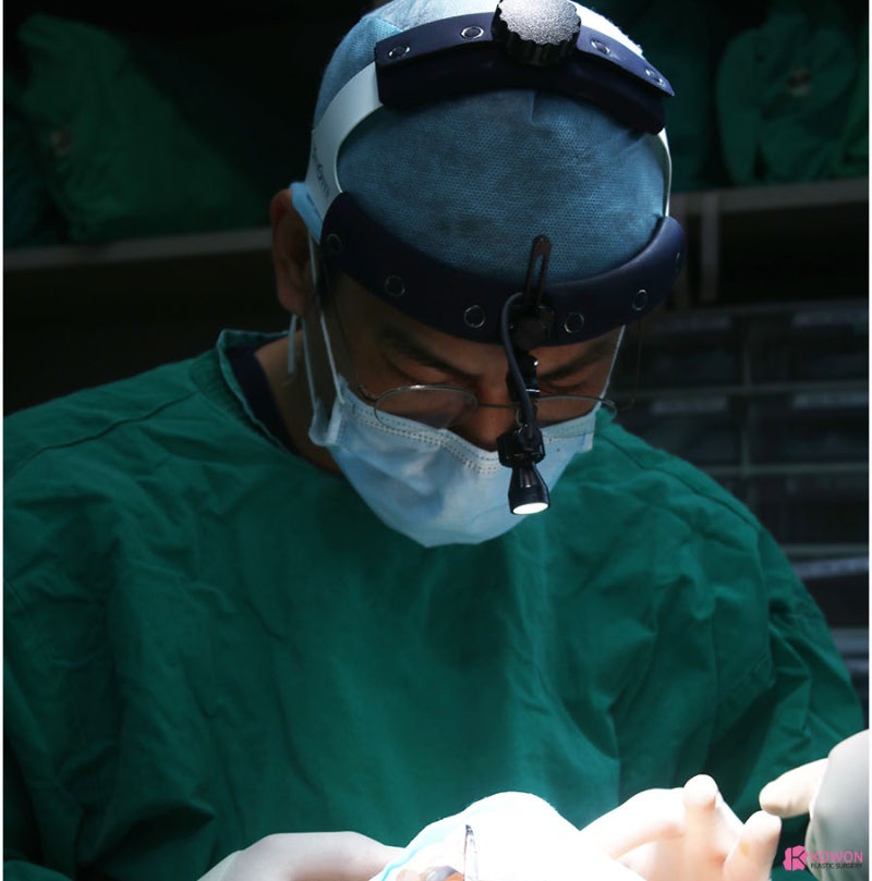 강남코성형외과추천 여자매부리코수술 전후 비교 사진 7
