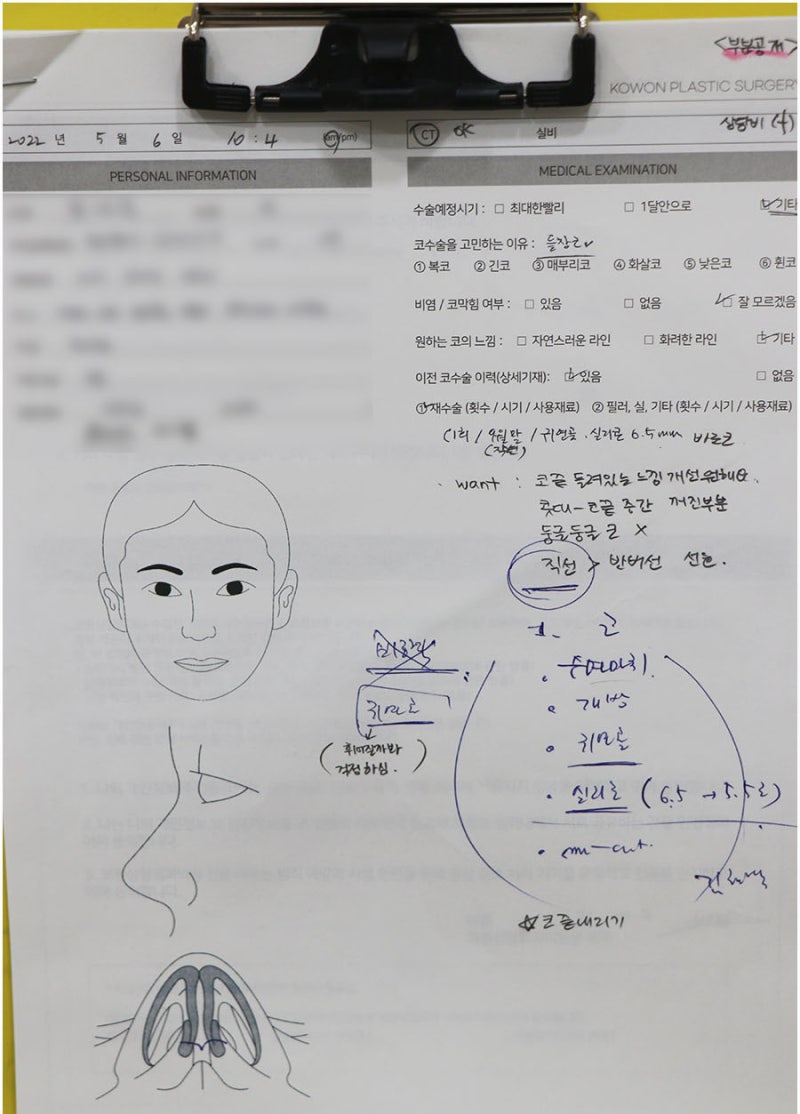 들창코성형수술 코성형유명한곳 찾는다면