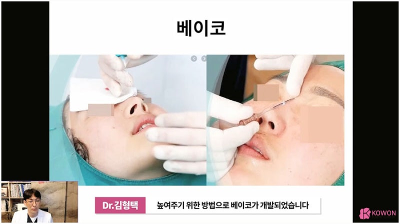 코보형물빼기 방법 주의사항 코재수술잘하는병원 사진 4