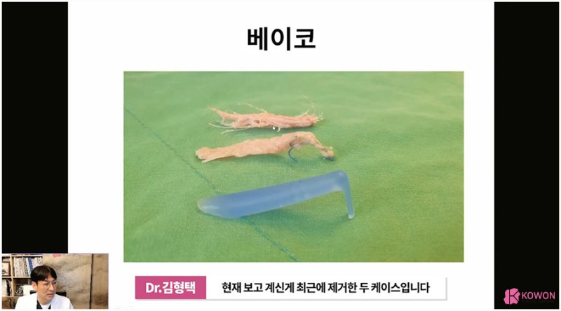 코보형물빼기 방법 주의사항 코재수술잘하는병원 사진 10