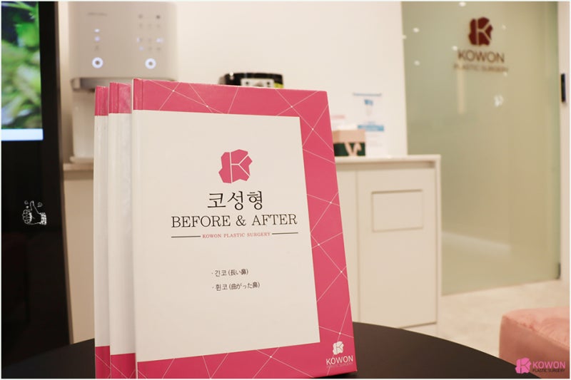 코재수술후기 화살코교정 알레르기 항생제 통증 사진 11