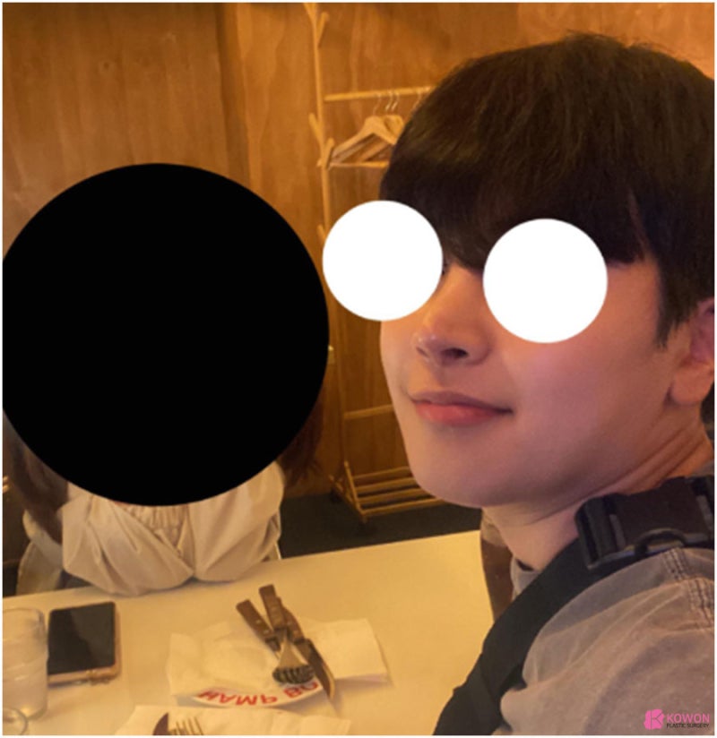 남자코재수술후기 콧구멍비대칭 맞춘 방법 사진 12