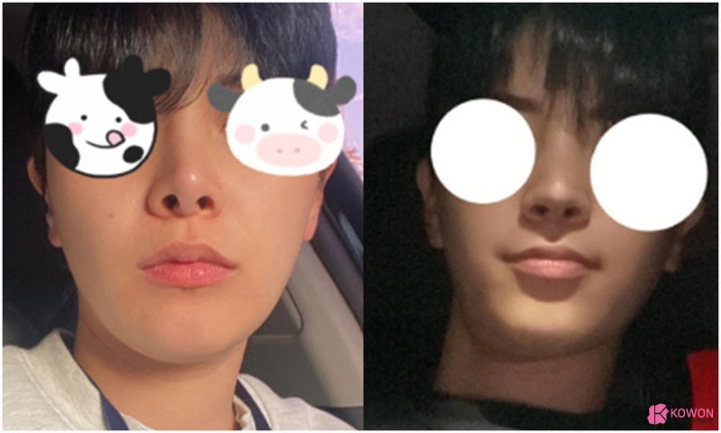 남자코재수술후기 콧구멍비대칭 맞춘 방법